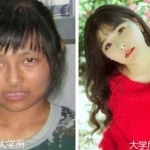 普通人整完容对比照片,揭秘整形前后惊人对比